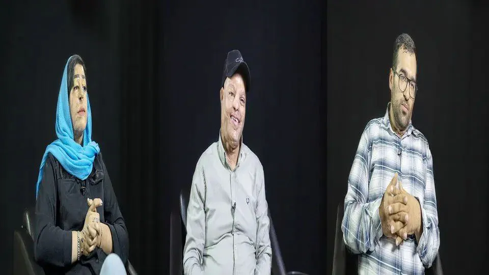  آدم‌هایی که با یک لیتر اسید، زندگی‌شان شکل دیگری پیدا کرده است