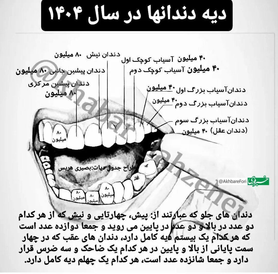  دیه هر دندان در سال ۱۴۰۴ چقدر است؟